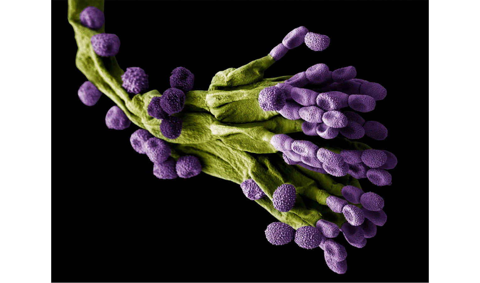 Гриб с пенициллином рода "Penicillium": важное открытие в медицине